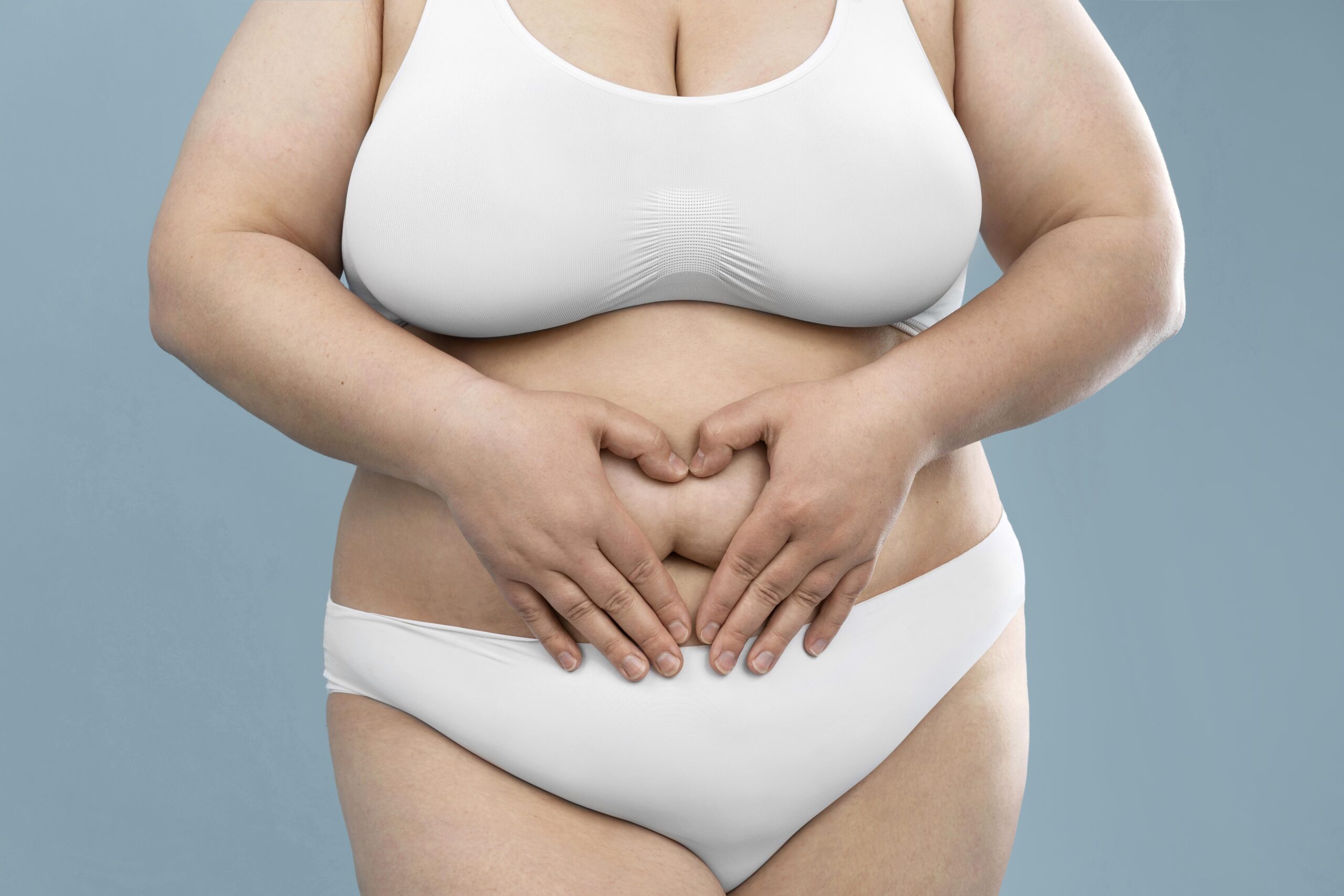 Em certos casos, não há tratamento clínico que resolva a obesidade. Somente a cirurgia bariátrica!
